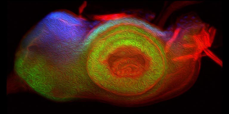 Light microscope image of an eye-antennal disc in which the eye field expresses non-retinal selector genes (in blue and green) and is transformed into epidermal tissue.
