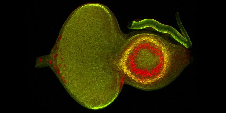 A light microscope image of an eye-antennal disc in which territories of the antennal disc are carved out by selector genes (in red and yellow).