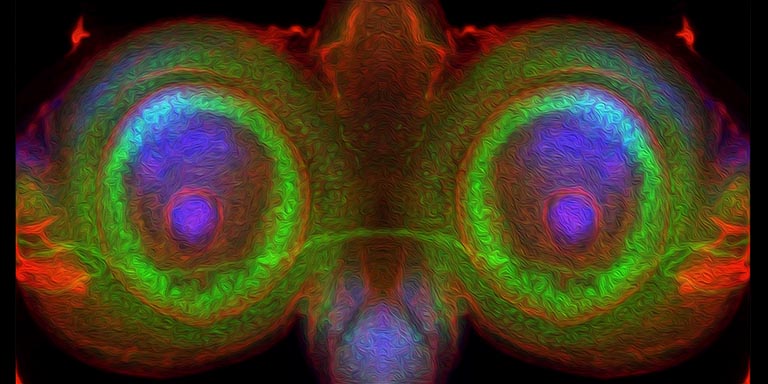 Light microscope image of an antennal segment that has been duplicated and fused together to create an owl-like image.