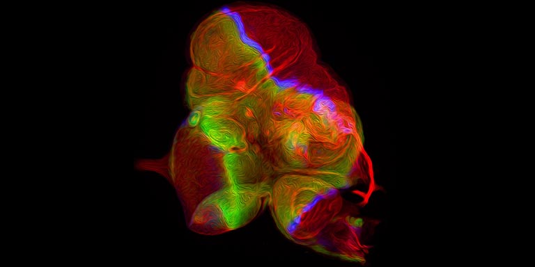 Eyes take flight – light microscope image of an eye-antennal disc in which the dorsal half of the eye has been transformed into a developing wing disc.
